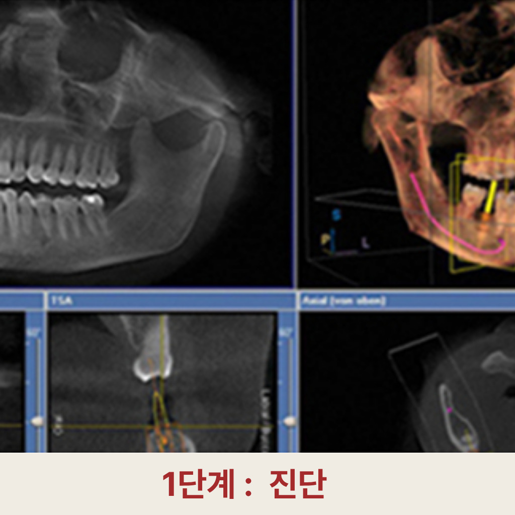 1단계: 진단